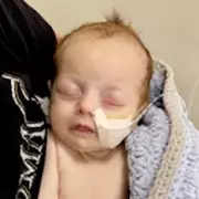 Baby Hospitalised with Meningitis B Despite No Rash Symptoms