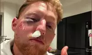 Ben Stokes Reveals He's 'Lucky to Be Alive' After Cheekbone Fracture