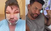 Bobby Norris Shares Bruised Post-Surgery Photos After Latest Cosmetic Procedures