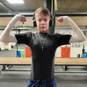 Bodybuilder with 'Butterfly Skin' Condition Defies Pain to Pursue Fitness Dreams