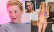 Brandi Glanville Hospitalised After TikTok Garlic Ear Remedy Goes Wrong