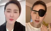 Chinese Influencer Zhu Mingyue Dies at 41 After Brave Cancer Battle