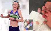 Eilish McColgan Reveals Gruesome Toe Injury During London Marathon