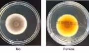 Fungal Pathogen Could Survive Journey to Mars, NASA Study Reveals