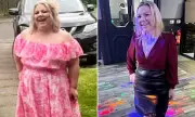 Gastric Sleeve Surgery: The Harsh Reality Behind Weight Loss Success Stories