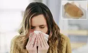 Greek Farmer Sneezes Out Live Worms After Sinus Pain, Doctors Shocked