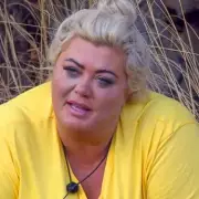 I'm A Celeb All Stars' Jungle Glow-Ups Exposed by Aesthetics Expert