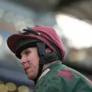 Jockey Kielan Woods Hospitalised After Fontwell Fall Days Before Grand National