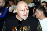 John Fury's Turbulent World: Eye-Gouging, Banana Diet, and Tyson Rift