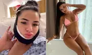 Love Island's Andrada Pop Returns to Turkey for More Cosmetic Surgery
