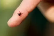 Lyme Disease Symptoms to Watch as ER Visits for Tick Bites Surge