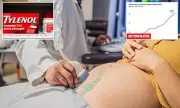 Major Study Finds No Link Between Acetaminophen in Pregnancy and Autism Risk