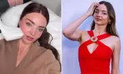 Miranda Kerr Reveals Secret to Youthful Skin with Sofwave Treatments