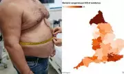 NHS Weight-Loss Surgery Triples in England as Obesity Treatment Demand Soars