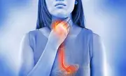 Pharmacist Rates Best Heartburn Remedies: Gaviscon Tops List