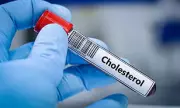 Simple £36 Cholesterol Test Could Better Predict Heart Attack Risk Than Standard Methods