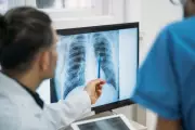Social Isolation Linked to 140,000 COPD Deaths Annually in US