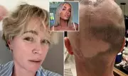 Teddi Mellencamp Asks Fans for Hair Styling Tips Amid Cancer Recovery