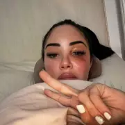 Tulisa Reveals Bell's Palsy Attack and Paralysis Amid Health Struggles