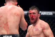 UFC Star's Title Shot in Doubt After 'Stupid Accident' Breaks Nose