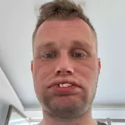UK Dad's £3,500 Turkey Dental Trip Leaves Him Toothless After Implants Fail