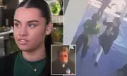 Waitress Attacked by Stranger: 'It's Your Fault' Assault Leads to Emergency Dental Surgery