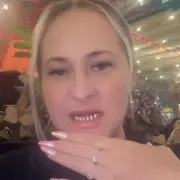 Woman Mistaken for Pensioner After Turkey Teeth Left Her with Stumps for Six Months