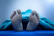 Zombie Filler: The Macabre US Trend Using Corpse Fat for Cosmetic Procedures