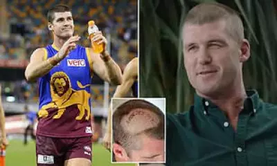 AFL Legend Jonathan Brown Reveals Brain Tumour Battle and Recovery
