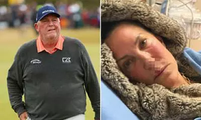 American golfer's wife attacked by family dog, needs stitches