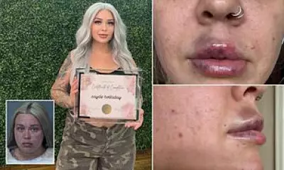 Arizona Woman Arrested for Unlicensed Botox and Lip Filler Injections