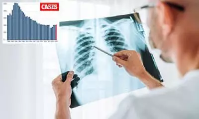 California TB Cases Hit 12-Year High: 2,150 Infections, 279 Deaths in 2025