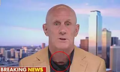 Fox News Guest's Neck Mark Sparks Mask Conspiracy Theory Debunked