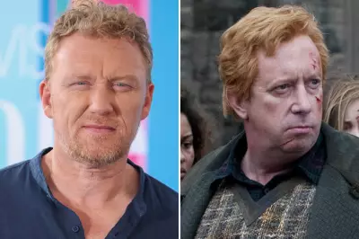 Grey's Anatomy Star Kevin McKidd Addresses Harry Potter Casting Rumors