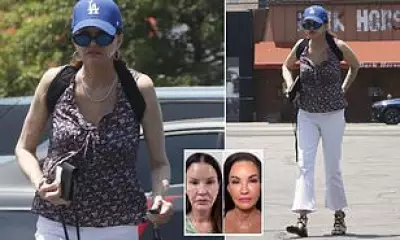 Janice Dickinson, 71, Spotted After Facelift, Looks 15 Years Younger