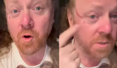 Keith Lemon actor Leigh Francis clawed in face by overzealous fan during DJ set
