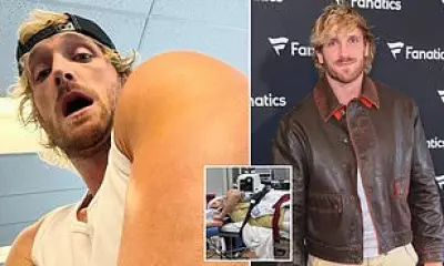 Logan Paul Reveals Gruesome Scar After Torn Triceps Surgery