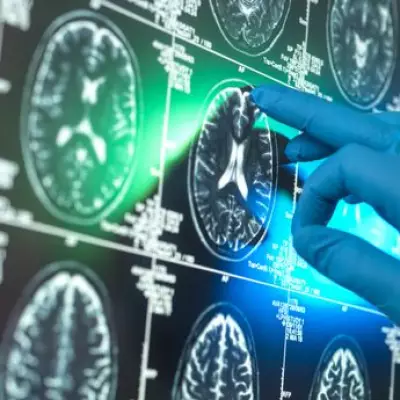 Long-Term Acid Reflux Drug Use Linked to 33% Higher Dementia Risk