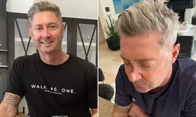 Michael Clarke Reveals Another Skin Cancer Surgery on His Face