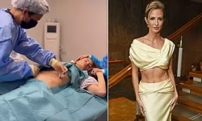 Millie Mackintosh Reveals BAFTA Abs Achieved with Skin Tightening