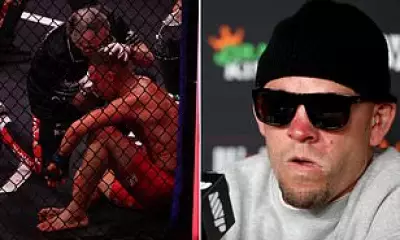 Nate Diaz Slurs Words After Brutal Loss, Fans Urge Retirement