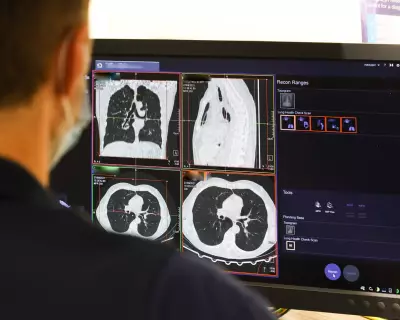 NHS pays record £241m outsourcing scan analysis to private firms