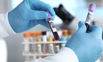 Pioneering Blood Test Detects 50+ Cancers Early, Could Save Thousands
