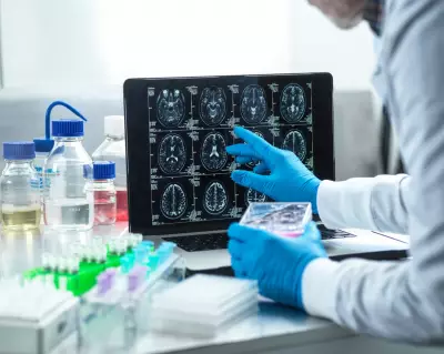 Slow Alzheimer’s Diagnoses Deny UK Patients Experimental Drugs
