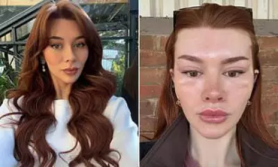 Woman Spends £9,000 on Facelift to Mimic Bella Hadid’s Cat Eye Look