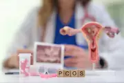6 Early Signs of PCOS Often Overlooked by Women