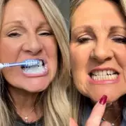 63-Year-Old Woman Says Teeth Look 20 Years Younger After £11 Whitening