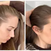 66p a Day Hair Supplement Reduces Shedding, Leaves Locks Glossy and Thick