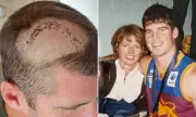 AFL Legend Jonathan Brown Reveals Mother's Sign Before Brain Surgery