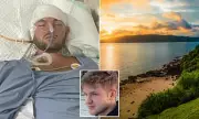 Australian Man Learns to Walk Again After Severe Brain Injury in Lombok